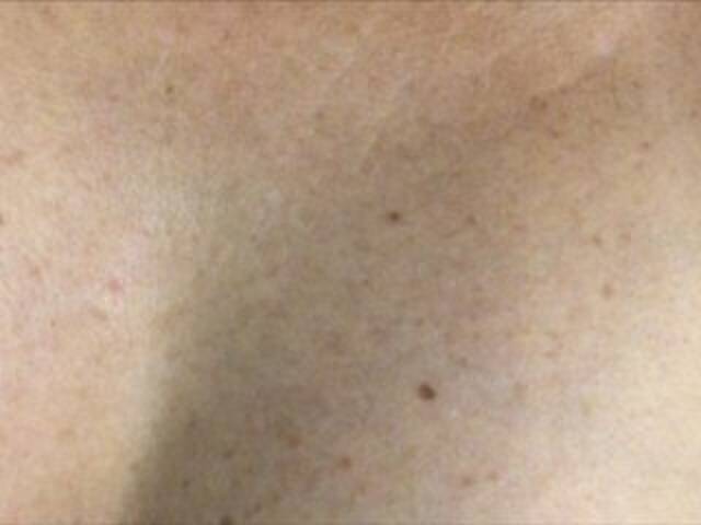 Capturas de pantalla de transmisión Alianakiss