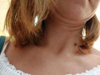 Chat de video erótico Nervomotalka